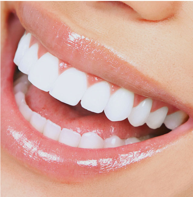 Stock image of a woman with teeth shown wide