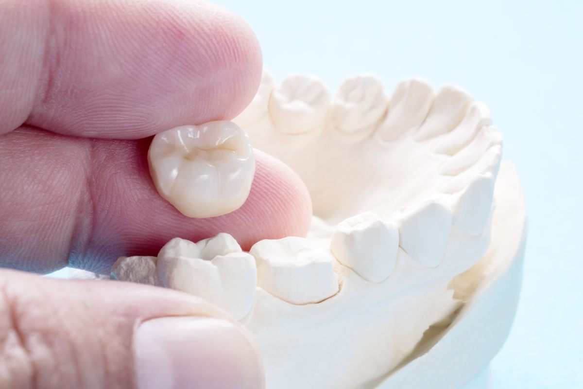concept of how to care for dental crowns