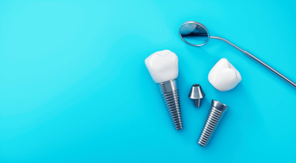 featured image for 5 key facts about dental implants