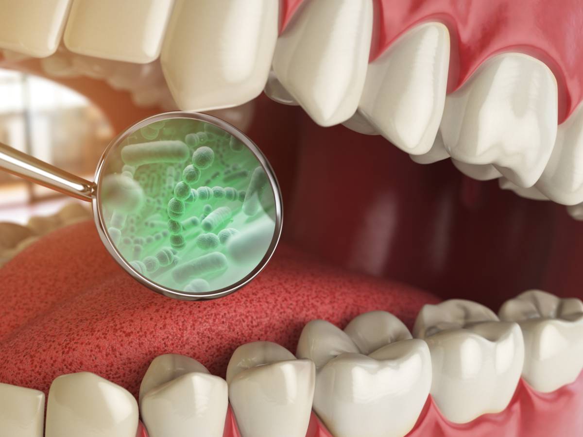 featured image for can gum disease cause bad breath